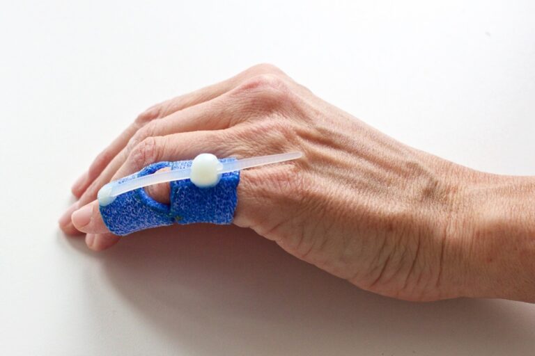Orfit Shell ORFIT Cast Aufbau - Ergotherapie Wicke