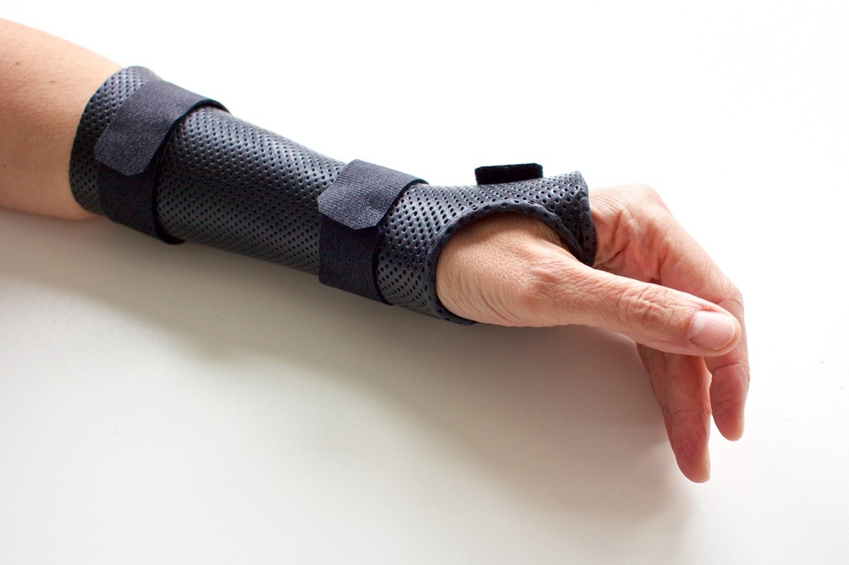 Schienenbau in einer ambulanten Praxis Handtherapie